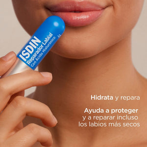 Imagen 2